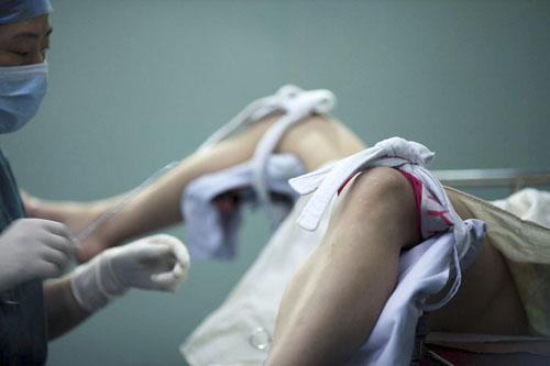 人流面临的四大常识问题,人流知识大全