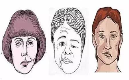 左眼跳是好事还是坏事的征兆,左眼跳是有好事发生还是坏事发生