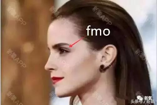 杨紫微整前后容颜对比,杨紫瘦了吗