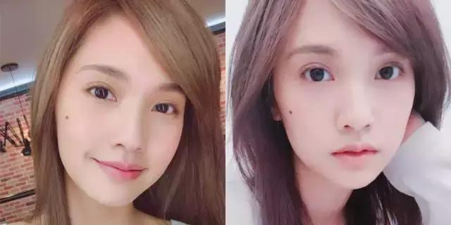 染发漂发之后怎么保护头皮,染发伤了头皮要擦什么药