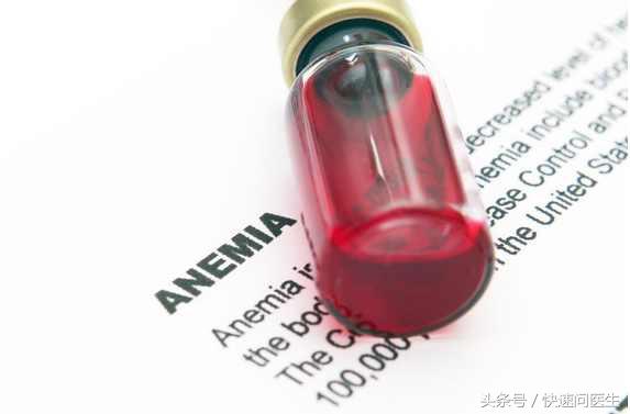 缺铁性贫血的原因及食补方法,缺铁性贫血症状如何补充营养