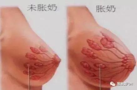 堵奶有硬块怎么快速疏通,堵奶了怎么办最快的解决方法