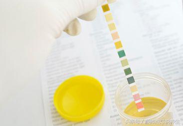 科普一张尿常规看懂你的肾,简单的尿常规能查出尿碘吗