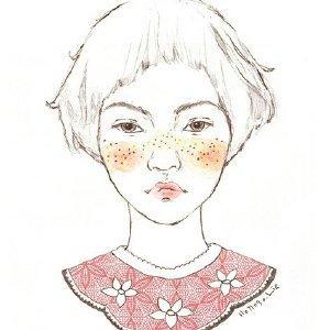 雀斑是什么原因引起的怎样去掉呢,雀斑应该怎么处理