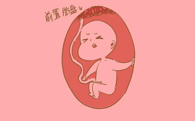 胎盘前置注意事项有哪些,孕后期胎盘前置需要注意什么