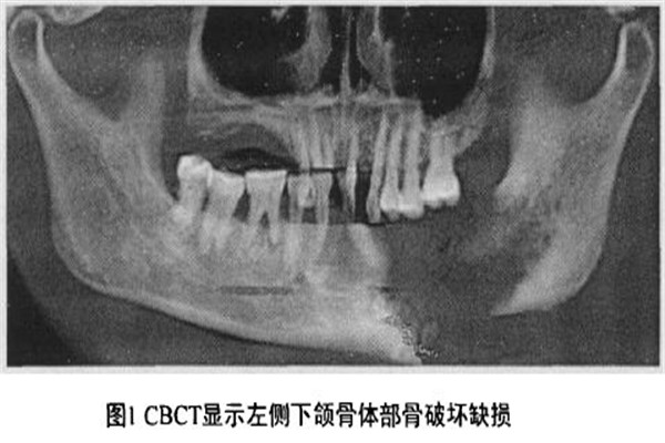 男子牙疼不及时治疗,男子强忍疼痛医院