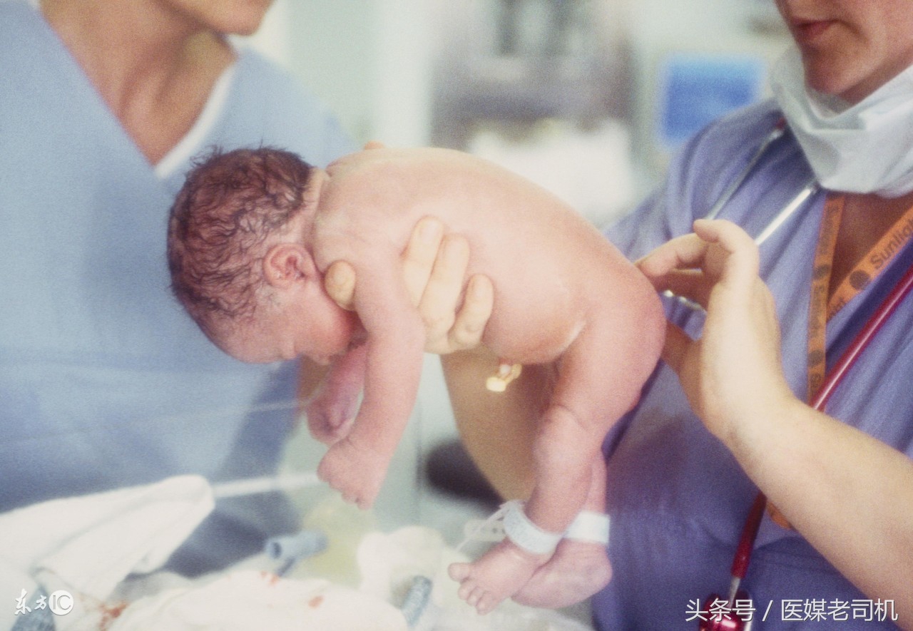 我的子宫我做主,如何选择顺产和剖宫产