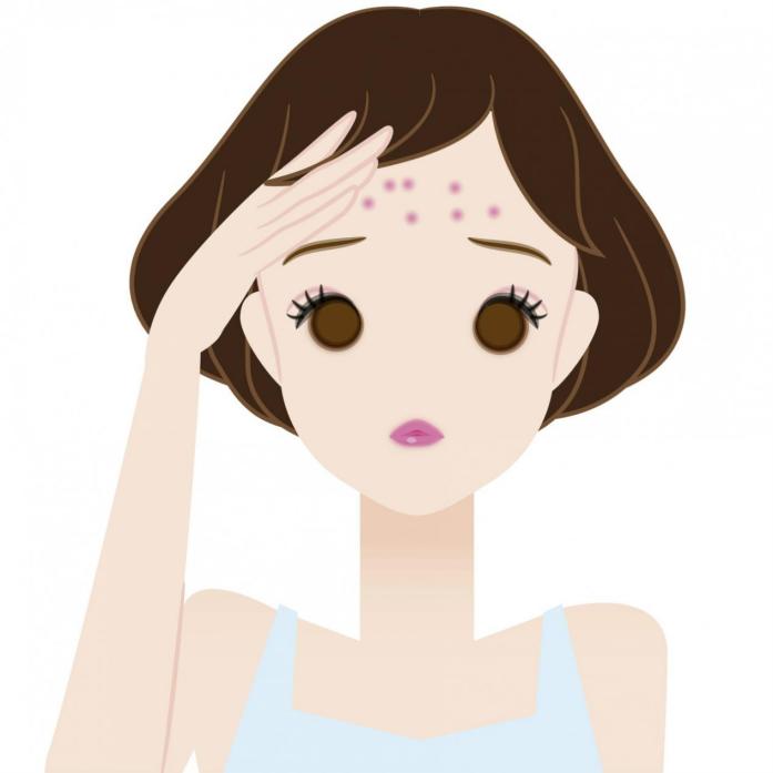 额头和下巴频繁起痘怎么护肤,脸颊两侧长痘的原因怎么护肤