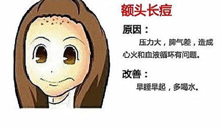额头和下巴一直反复长痘怎么回事,额头和太阳穴两侧长痘是什么原因