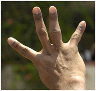 伟大的象征:孙杨的指纹、郭晶晶的眼睛、詹姆斯的脚趾、科比的手