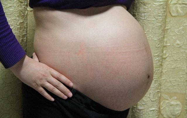 产妇上大厕出血，以为是产后正常现象，谁知道医生的话让她懵了