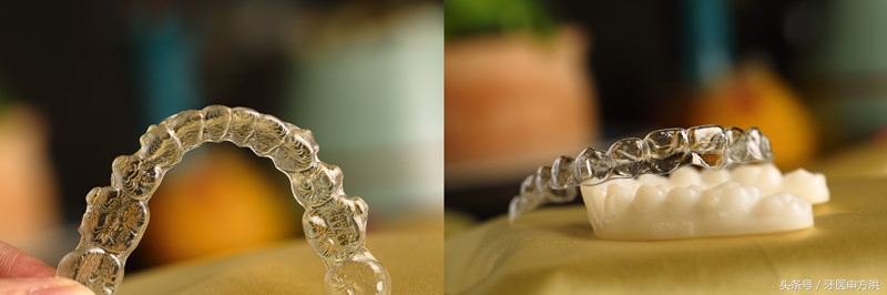 隐形牙套哪个品牌好,隐形牙套到底是什么