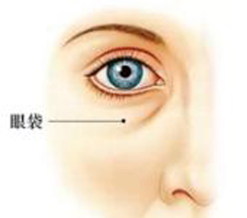 去除黑眼圈眼袋最有效的眼霜,去除眼袋黑眼圈最有效的方法