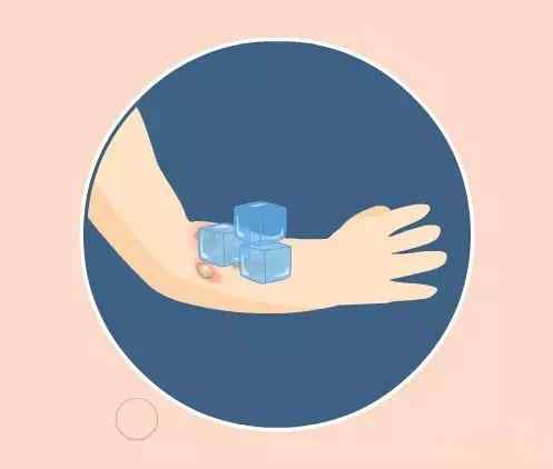 关节扭伤后的处理,扭伤手指关节怎么处理