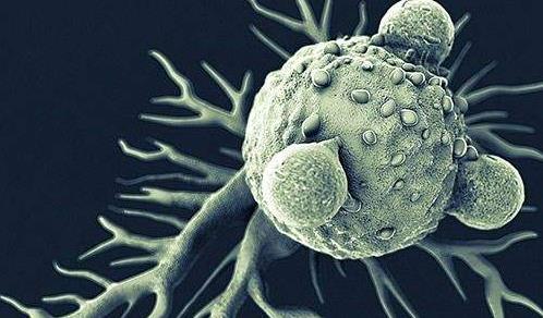 高仓健患淋巴瘤,高仓健淋巴瘤