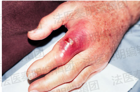 我们真的不想在假期开始前来一期重口味更新的