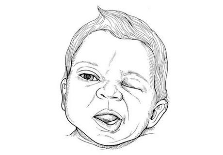 有专治半边瘫的医院吗,全国治半边瘫排名第一的医院