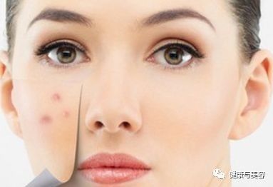 斑点消除办法,斑点的形成和去除方法