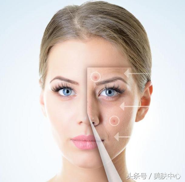 痘印怎么祛16个祛除痘印的小妙招,快速祛除痘印的三个方法