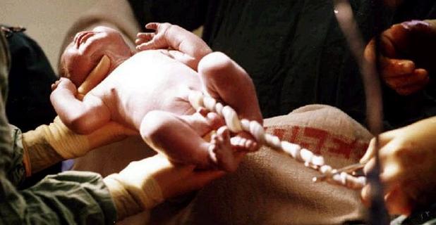 实拍胎儿剖腹产过程，“捧在手里怕摔了，含在嘴里怕化了”！