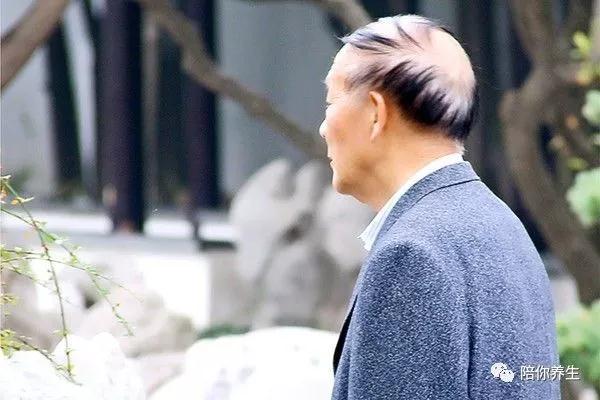 为什么男人易秃顶,为什么男人到了中年就容易秃顶呢