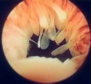 女性妇科疾病和哪个脏器有关,女性的妇科疾病大多是男性造成的