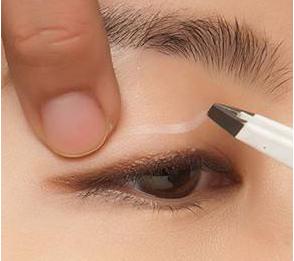 内双眼皮怎么变外双费用多少,眼皮一个内双一个外双怎么矫正