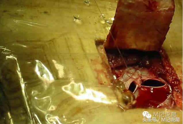 苏卡达陆龟乌龟卡脖子,苏卡达陆龟下颚裂开