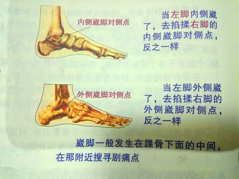 足部护理足跟痛,足跟痛足底穴位