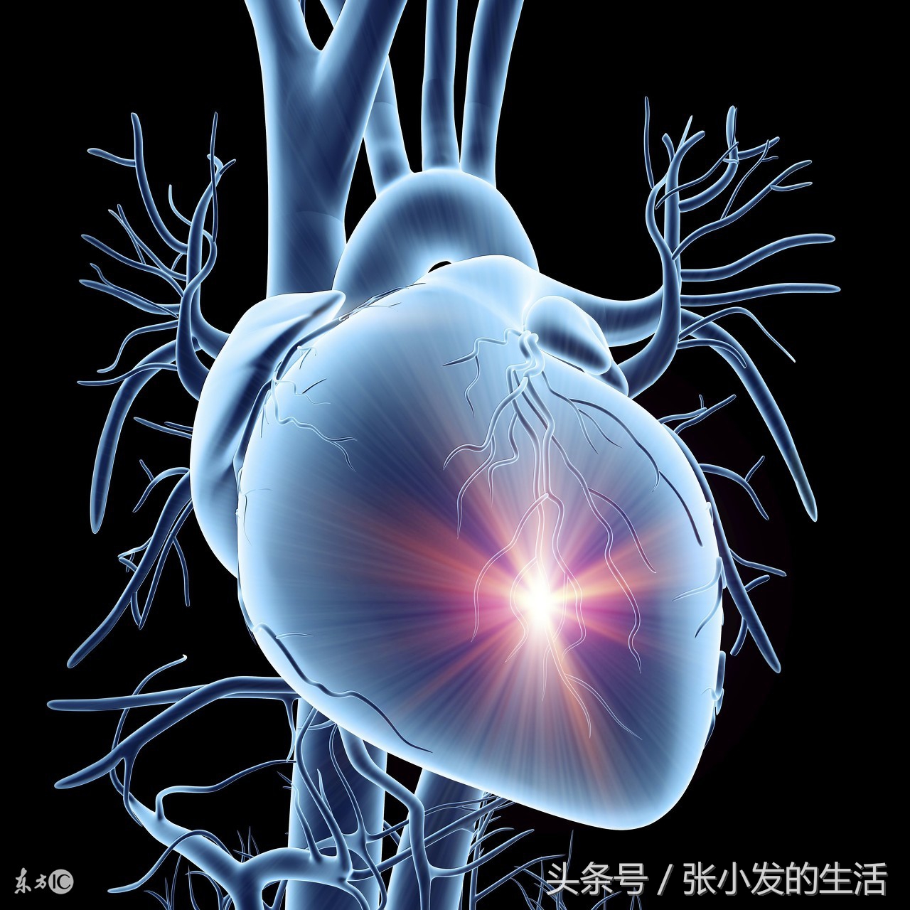 心绞痛与急性心肌梗死的鉴别,不稳定型心绞痛和急性心肌梗死