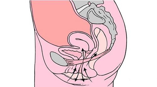 凯格尔运动,会阴收缩的凯格尔运动