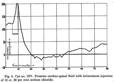 良性高颅压怎么治疗,高颅压治疗
