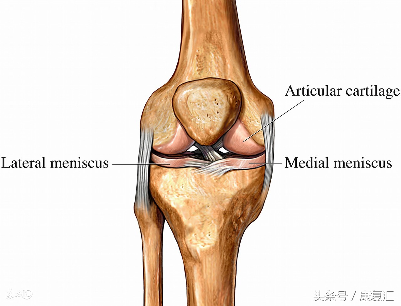 膝关节内侧副韧带损伤要多久恢复,膝关节内侧副韧带损伤如何治疗
