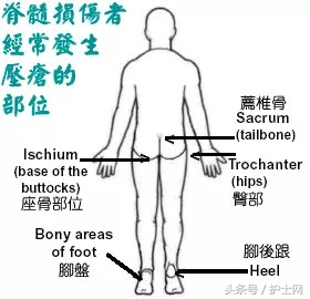 压疮的普及,压疮演变