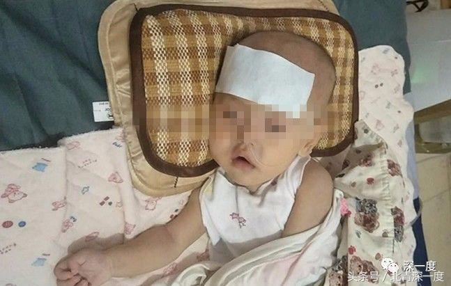 罕见病200万一年,不可治愈的罕见病有哪些