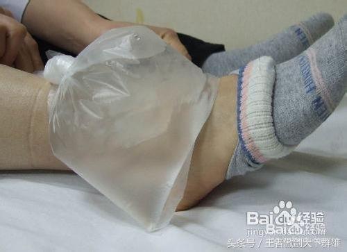 脚崴到了肿了应该怎么办,脚崴到了肿了怎么办多久可以好