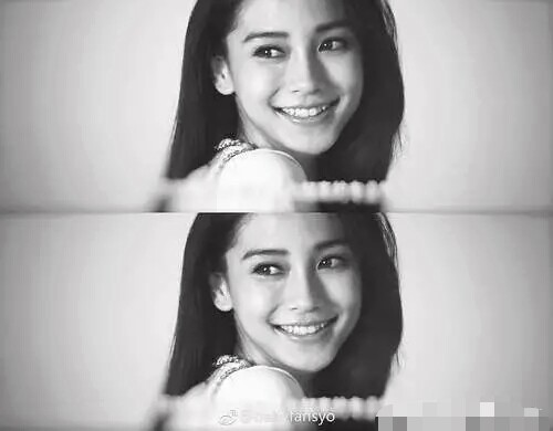 高圆圆戴牙套前后对比,高圆圆牙齿矫正牙套戴了几年