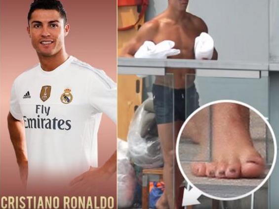 詹姆斯的脚趾头科比的手,科比的手指和脚趾