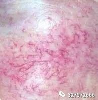 朵嘉浓能修复角质层吗,朵嘉浓祛红血丝好用吗