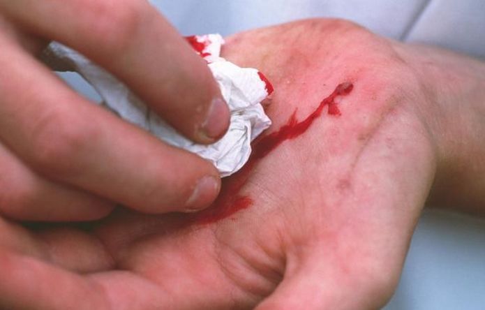 38岁剖腹产生二胎,44岁剖腹产第二胎