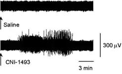 迷走神经电刺激疗法的作用是,迷走神经刺激术治疗副作用