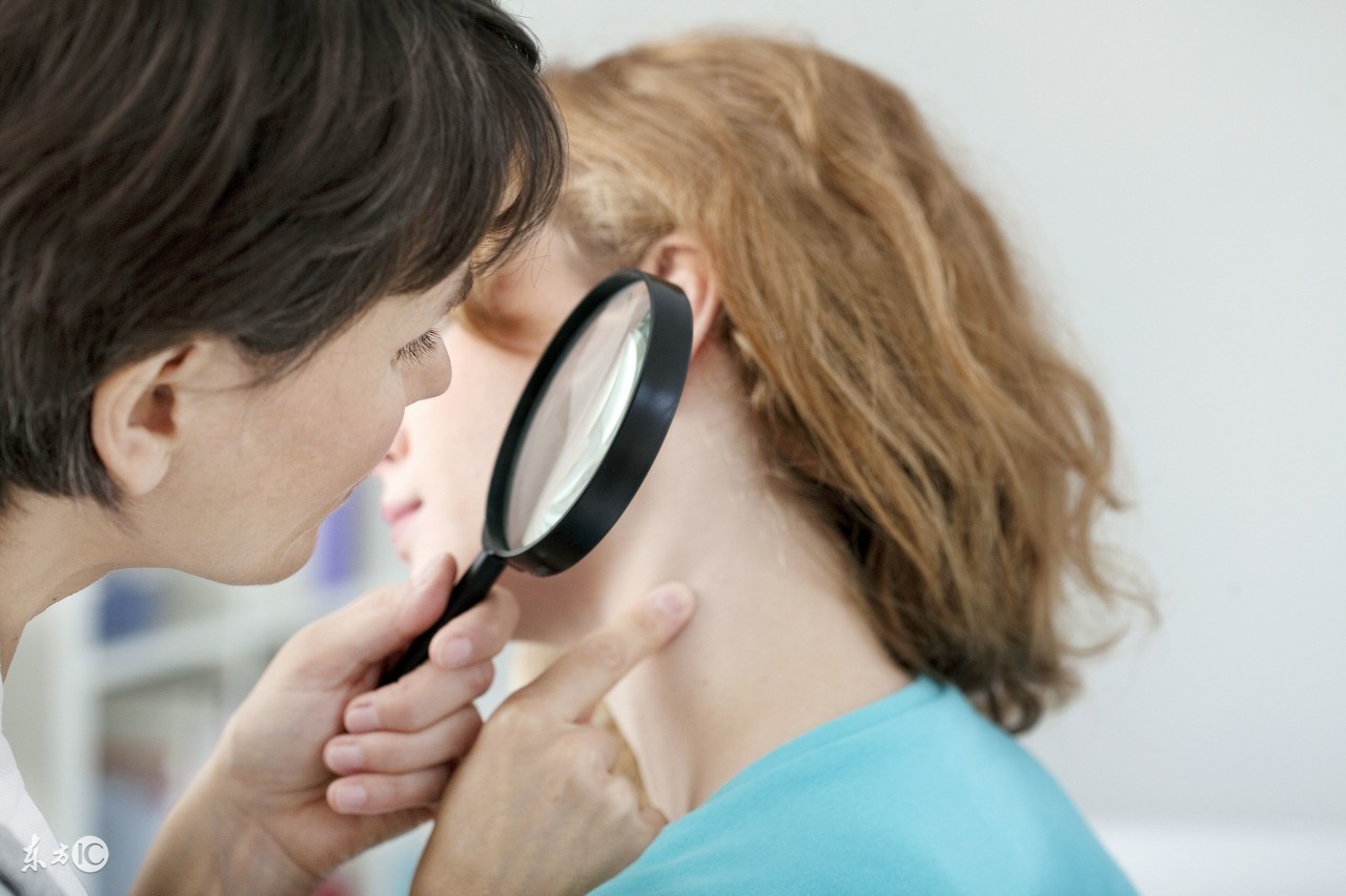 改善脸上小毛孔小颗粒,改善脸上粉刺