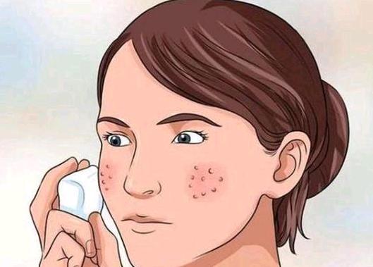 敷面膜的过程怎么判断是否过敏,面膜里面含哪两种成分对皮肤不好