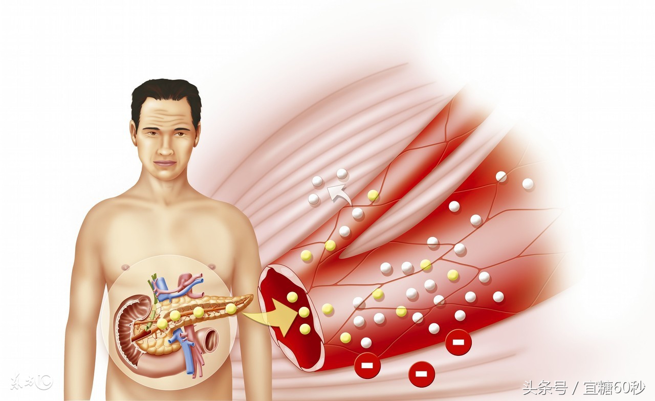 胰岛素分泌高峰延迟是糖尿病吗,血糖正常但是胰岛素分泌高峰延迟