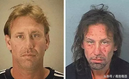 10个吸毒前后的惊人变化,吸毒的人吸毒前后对比图片