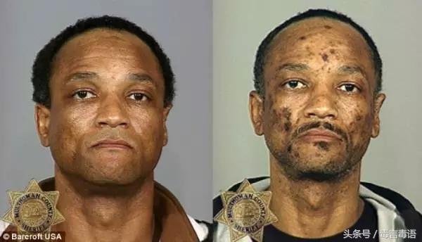 吸毒前后的变化对比,吸毒真的会毁容吗