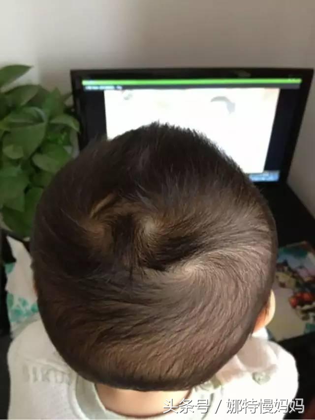 宝宝的头旋有什么说法吗,宝宝的头旋为啥是歪的