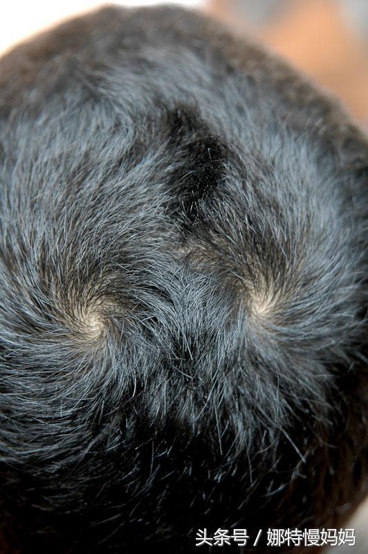 宝宝头旋歪了有啥说法,宝宝有两个头旋有什么说法