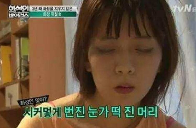 日本姑娘得了怪病,日本女明星疾病