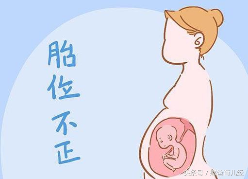 怀孕8个月胎位不正应该怎么办,怀孕8个多月胎位不正怎么办